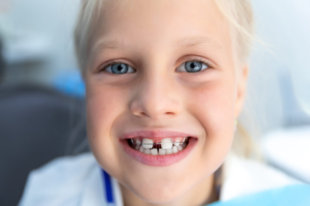 Little blond happy kid girl at dentist office smiling showing diastema overbite teeth missing gap. Child during an orthodontist visit and oral cavity check-up. Children's tooth care and hygiene.